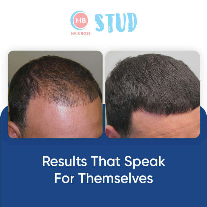 Specialized hair growth product for fast, healthy hair results